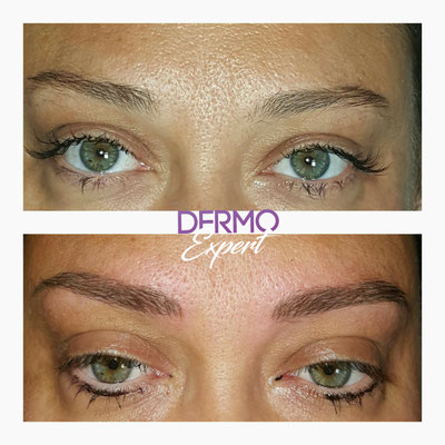 Dermopigmentation et maquillage permanent